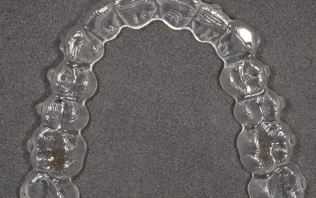 Cortar el alineador a distal del 7 en una distalización ¿verdad o moda?