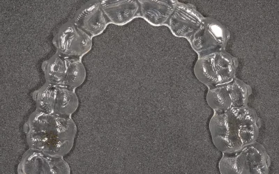 Cortar el alineador a distal del 7 en una distalización ¿verdad o moda?