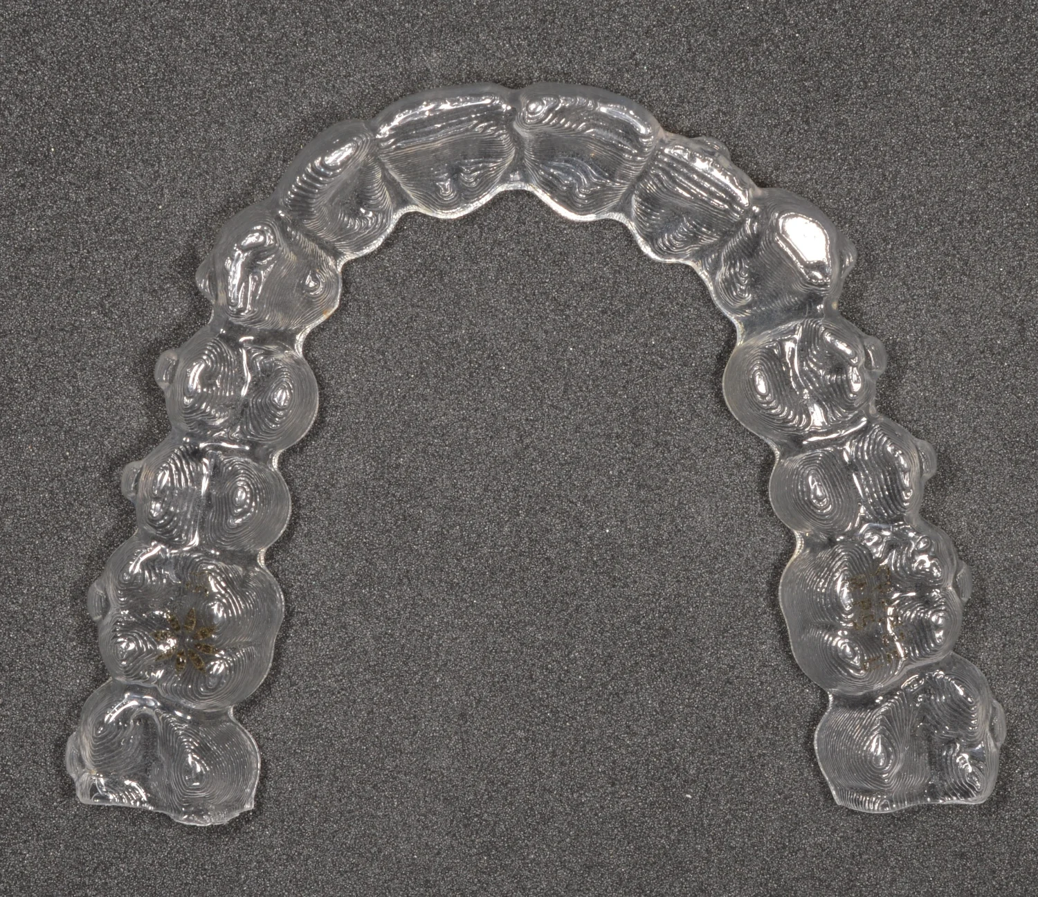 Cortar el alineador a distal del 7 en distalización, ¿verdad o moda?